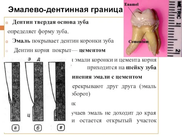 Эмалево-дентинная граница Дентин твердая основа зуба определяет форму зуба. Эмаль покрывает