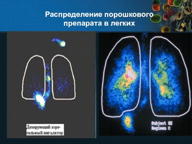 Распределение порошкового препарата в легких