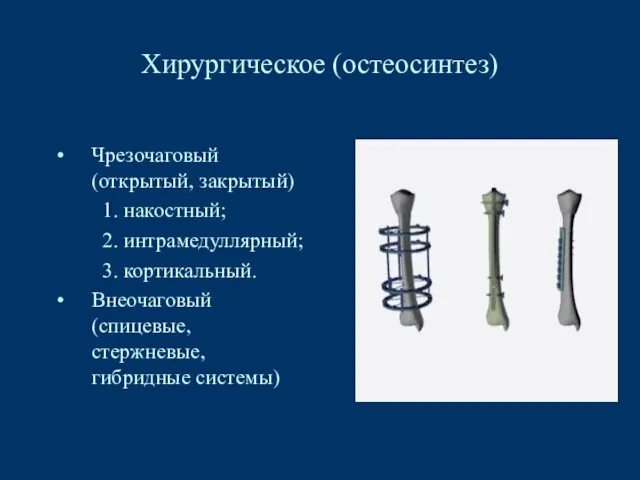 Хирургическое (остеосинтез) Чрезочаговый (открытый, закрытый) 1. накостный; 2. интрамедуллярный; 3. кортикальный. Внеочаговый (спицевые, стержневые, гибридные системы)