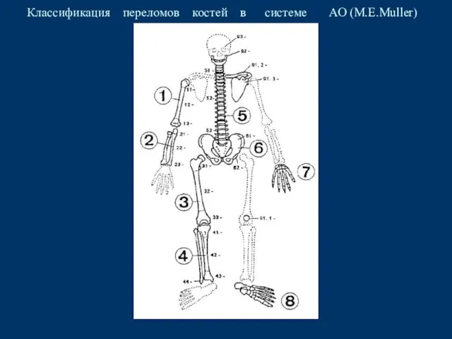 Классификация переломов костей в системе АО (M.E.Muller)