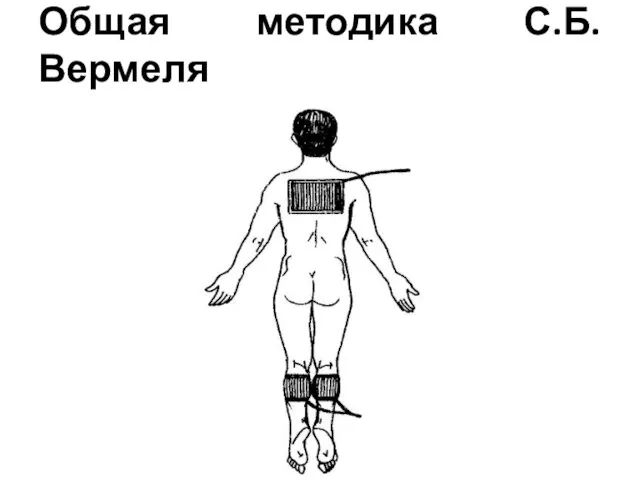 Общая методика С.Б.Вермеля