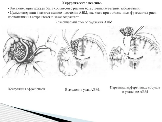 Хирургическое лечение. • Риск операции должен быть соотнесен с риском естественного