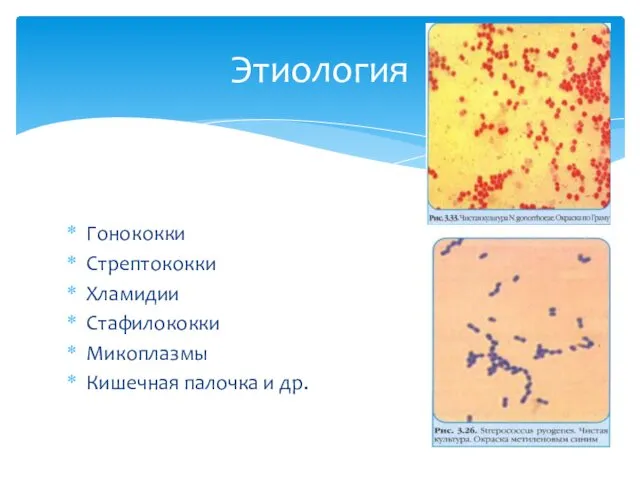 Гонококки Стрептококки Хламидии Стафилококки Микоплазмы Кишечная палочка и др. Этиология