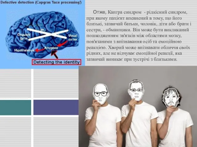 Отже, Капгра синдром - рідкісний синдром, при якому пацієнт впевнений в