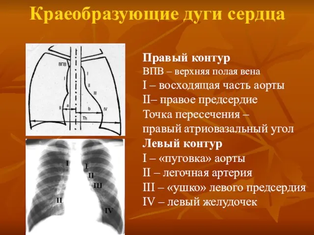 Краеобразующие дуги сердца Правый контур ВПВ – верхняя полая вена I