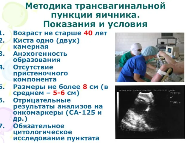 Методика трансвагинальной пункции яичника. Показания и условия Возраст не старше 40