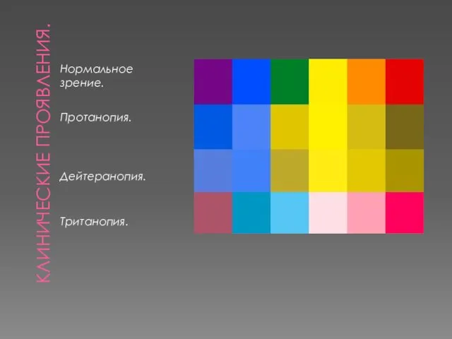 КЛИНИЧЕСКИЕ ПРОЯВЛЕНИЯ. Нормальное зрение. Протанопия. Дейтеранопия. Тританопия.