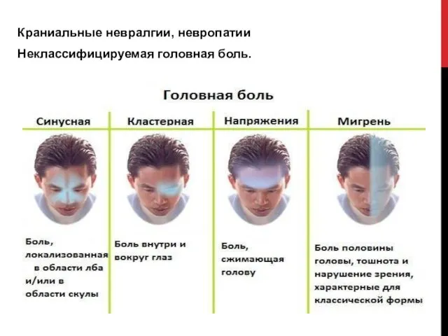 Краниальные невралгии, невропатии Неклассифицируемая головная боль.