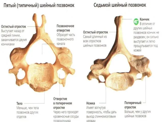 Шейные позвонки Главное отличие - отверстия в поперечных отростках и раздвоение