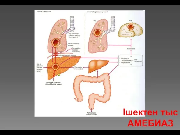 Ішектен тыс АМЕБИАЗ