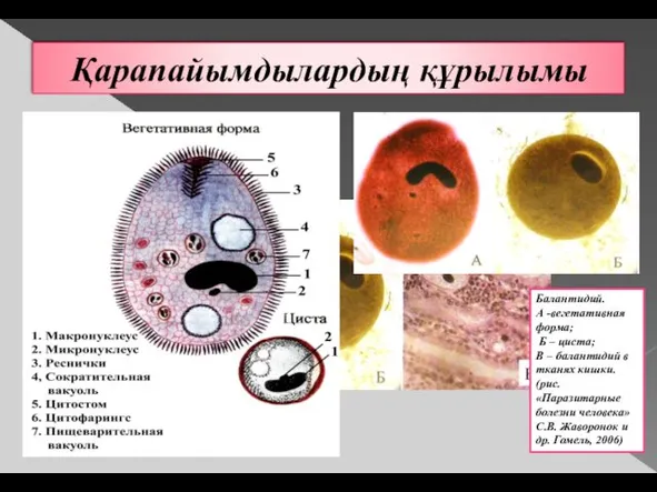 Қарапайымдылардың құрылымы Балантидий. А -вегетативная форма; Б – циста; В –