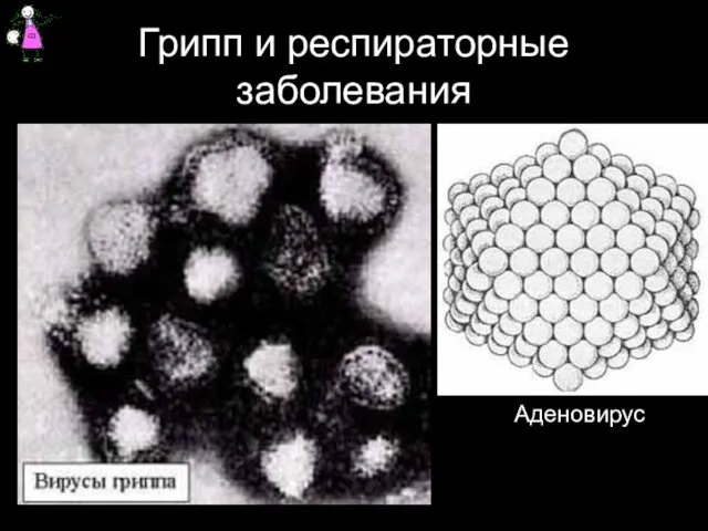 Грипп и респираторные заболевания Аденовирус