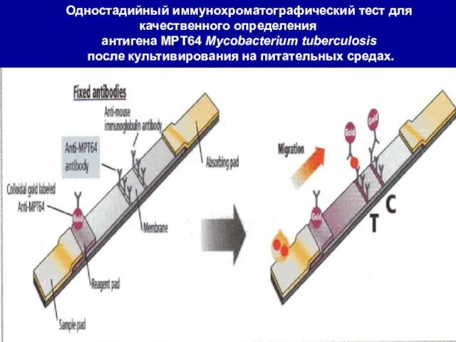 Одностадийный иммунохроматографический тест для качественного определения антигена MPT64 Mycobacterium tuberculosis после культивирования на питательных средах.