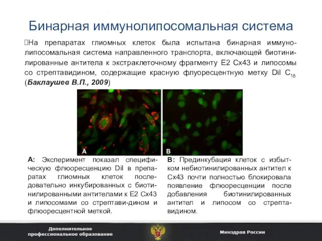 Бинарная иммунолипосомальная система На препаратах глиомных клеток была испытана бинарная иммуно-липосомальная