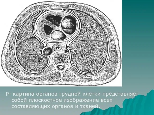 Р- картина органов грудной клетки представляет собой плоскостное изображение всех составляющих органов и тканей.