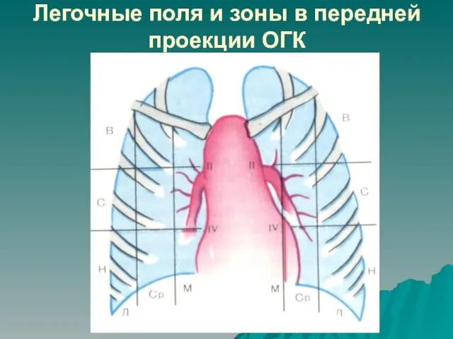 Легочные поля и зоны в передней проекции ОГК