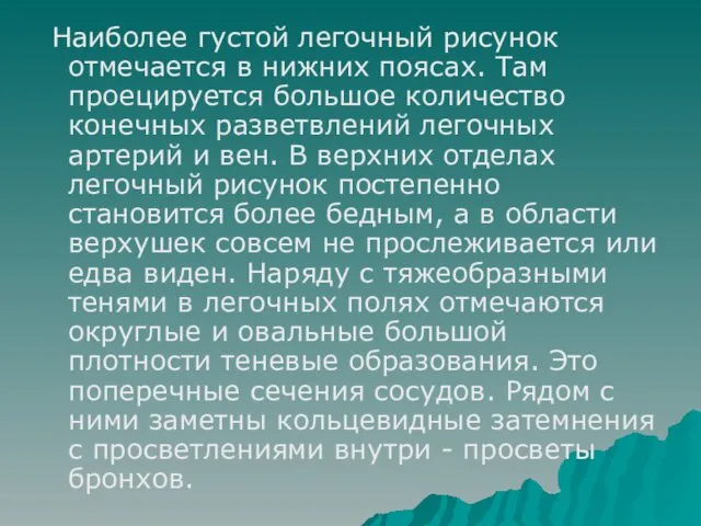 Наиболее густой легочный рисунок отмечается в нижних поясах. Там проецируется большое