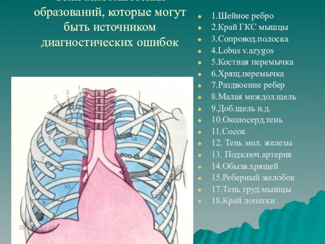 Тени анатомических образований, которые могут быть источником диагностических ошибок 1.Шейное ребро