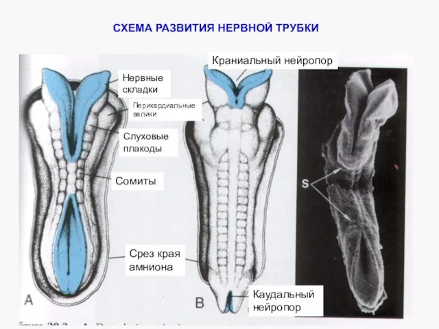 Срез края амниона Сомиты Слуховые плакоды Перикардиальные валики Нервные складки Краниальный