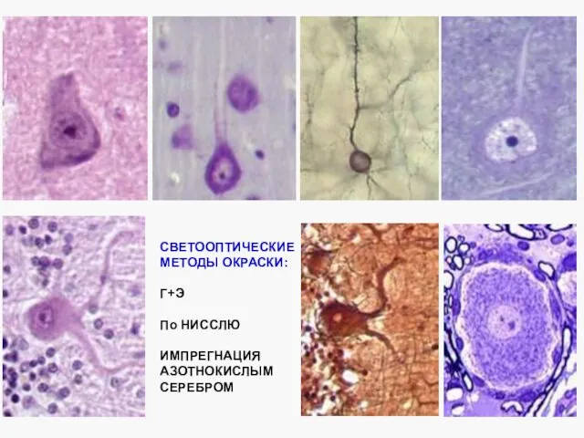 СВЕТООПТИЧЕСКИЕ МЕТОДЫ ОКРАСКИ: Г+Э По НИССЛЮ ИМПРЕГНАЦИЯ АЗОТНОКИСЛЫМ СЕРЕБРОМ