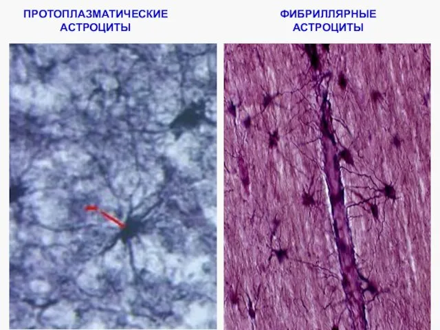 ФИБРИЛЛЯРНЫЕ АСТРОЦИТЫ ПРОТОПЛАЗМАТИЧЕСКИЕ АСТРОЦИТЫ