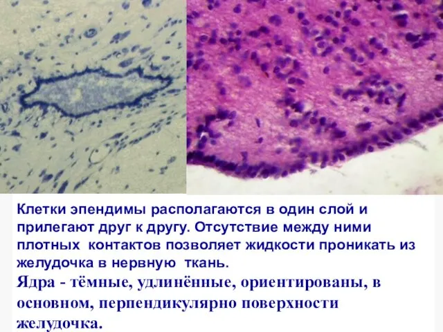 Эпендимная глия Эпендимоциты образуют плотный слой клеток, выстилающих спинномозговой канал и