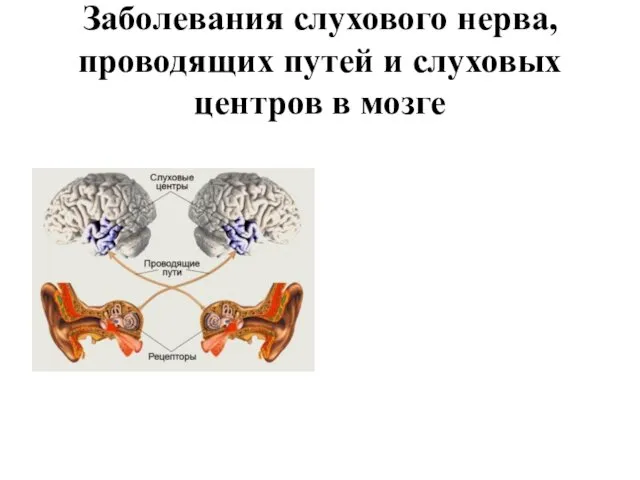 Заболевания слухового нерва, проводящих путей и слуховых центров в мозге