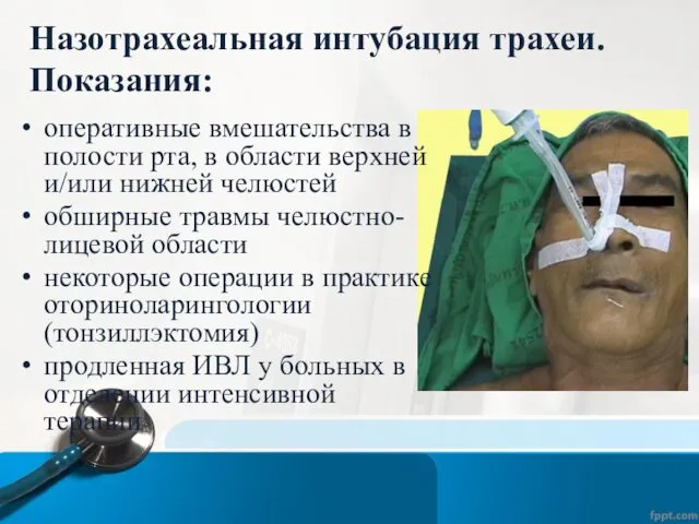 Назотрахеальная интубация трахеи. Показания: оперативные вмешательства в полости рта, в области