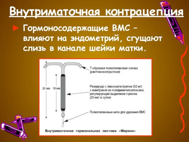 Внутриматочная контрацепция Гормоносодержащие ВМС – влияют на эндометрий, сгущают слизь в канале шейки матки.