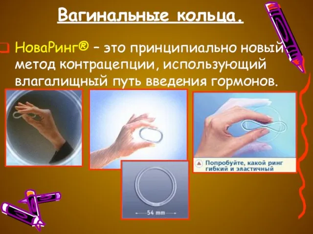 Вагинальные кольца. НоваРинг® – это принципиально новый метод контрацепции, использующий влагалищный путь введения гормонов.