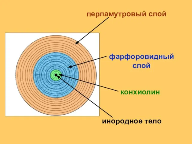 инородное тело фарфоровидный слой перламутровый слой конхиолин