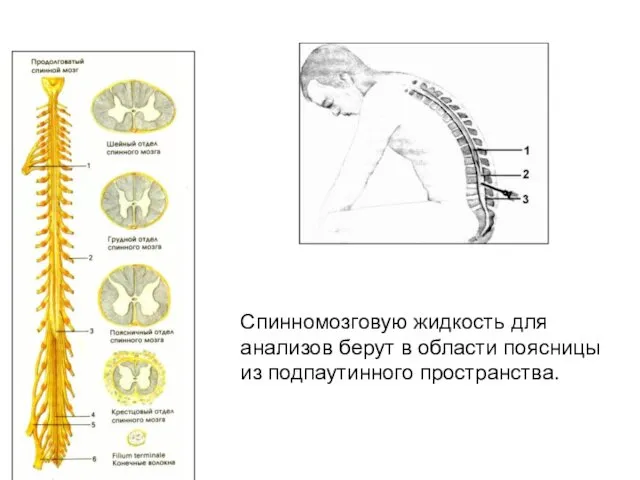 Спинномозговую жидкость для анализов берут в области поясницы из подпаутинного пространства.