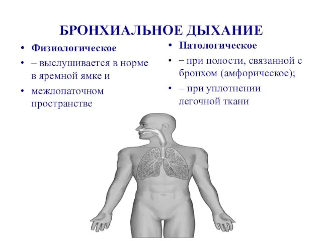 БРОНХИАЛЬНОЕ ДЫХАНИЕ Физиологическое – выслушивается в норме в яремной ямке и