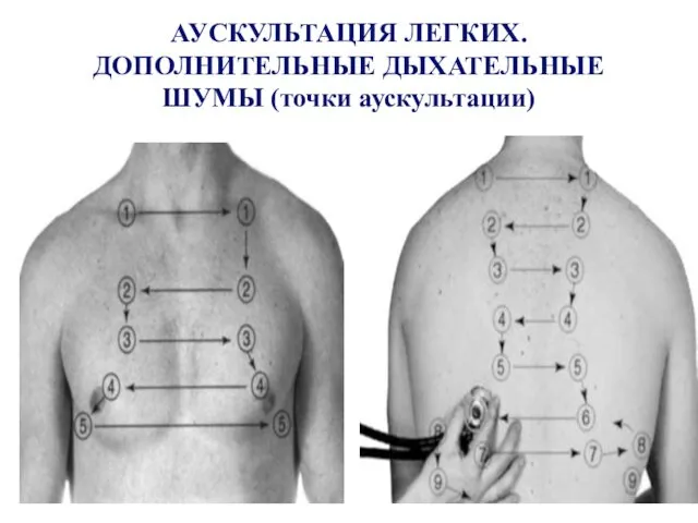 АУСКУЛЬТАЦИЯ ЛЕГКИХ. ДОПОЛНИТЕЛЬНЫЕ ДЫХАТЕЛЬНЫЕ ШУМЫ (точки аускультации)