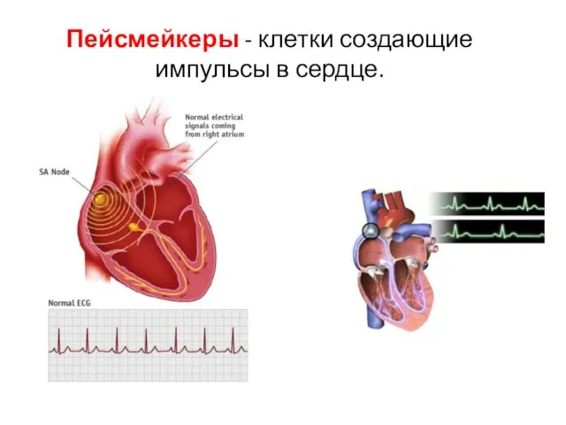 Пейсмейкеры - клетки создающие импульсы в сердце.