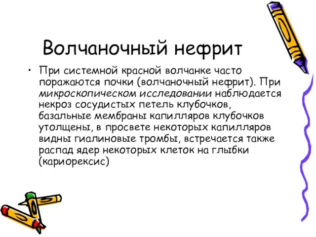 Волчаночный нефрит При системной красной волчанке часто поражаются почки (волчаночный нефрит).