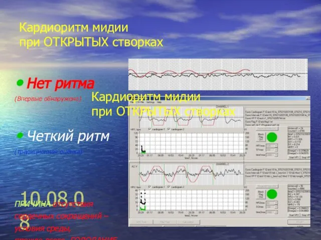 10.08.08 Нет ритма (Впервые обнаружено) Четкий ритм (традиционная оценка) ПРИЧИНА отсутствия