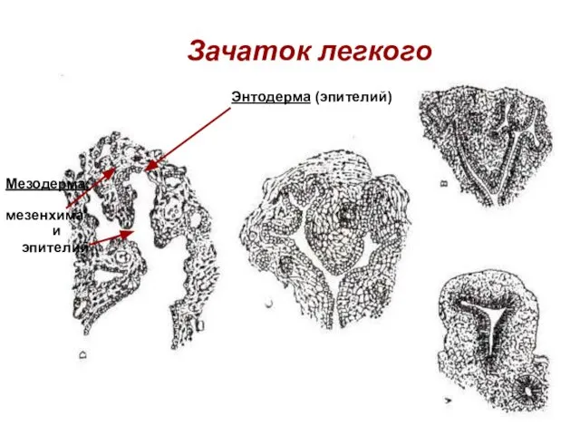 Зачаток легкого Энтодерма (эпителий) мезенхима эпителий Мезодерма: и