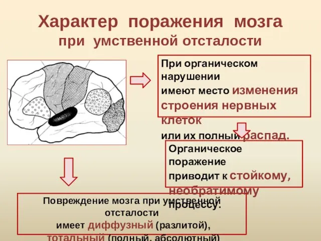 Характер поражения мозга при умственной отсталости Повреждение мозга при умственной отсталости