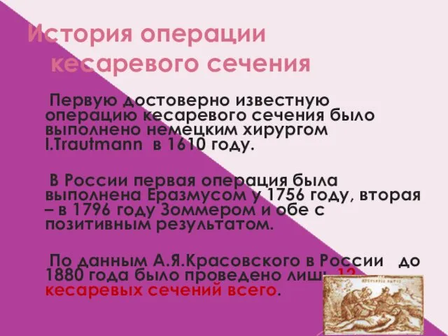 История операции кесаревого сечения Первую достоверно известную операцию кесаревого сечения было