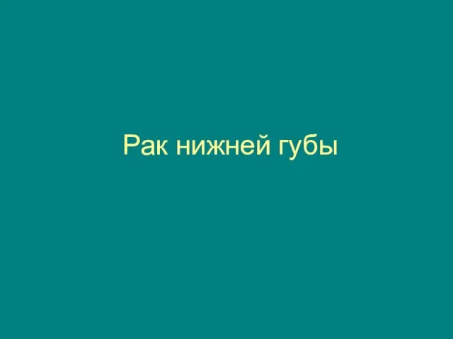 Рак нижней губы