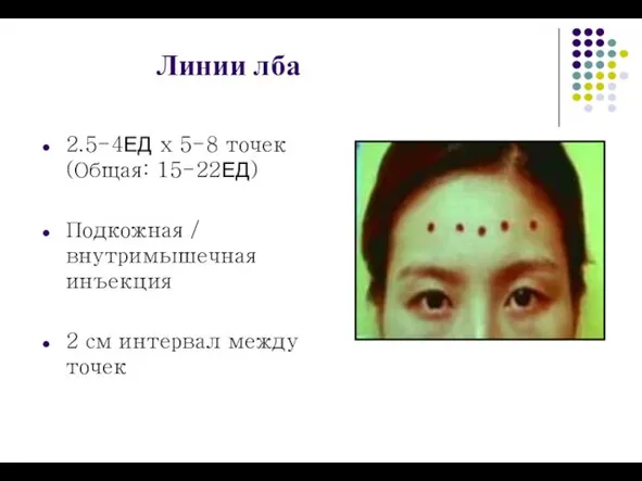 Линии лба 2.5-4ЕД x 5-8 точек (Общая: 15-22ЕД) Подкожная / внутримышечная