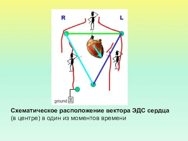 Схематическое расположение вектора ЭДС сердца (в центре) в один из моментов времени