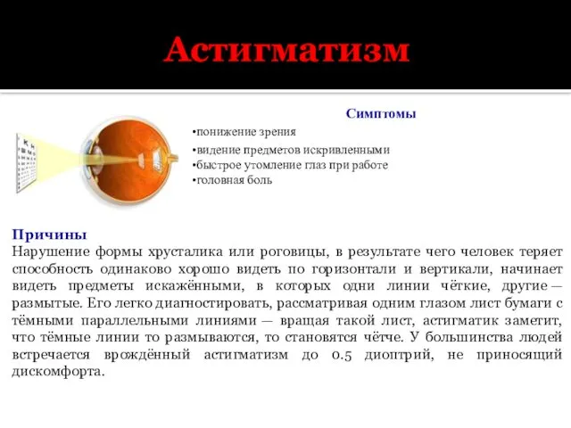 Астигматизм Симптомы понижение зрения видение предметов искривленными быстрое утомление глаз при