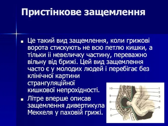 Пристінкове защемлення Це такий вид защемлення, коли грижові ворота стискують не