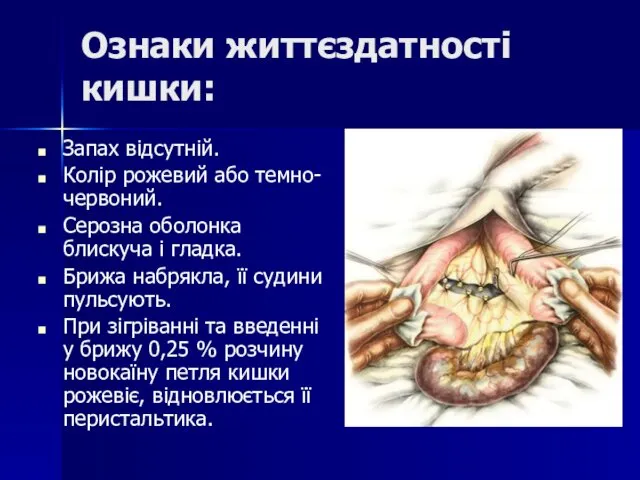 Ознаки життєздатності кишки: Запах відсутній. Колір рожевий або темно-червоний. Серозна оболонка