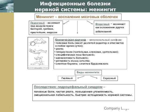 Company Logo Инфекционные болезни нервной системы: менингит Менингит – воспаление мозговых