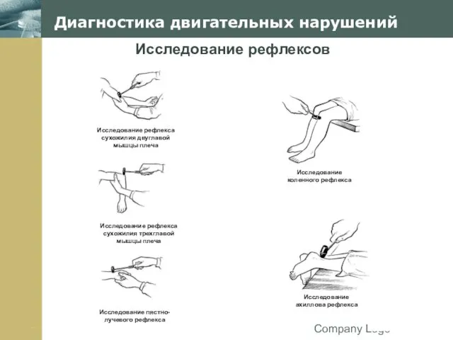 Company Logo Диагностика двигательных нарушений Исследование рефлексов Исследование рефлекса сухожилия двуглавой