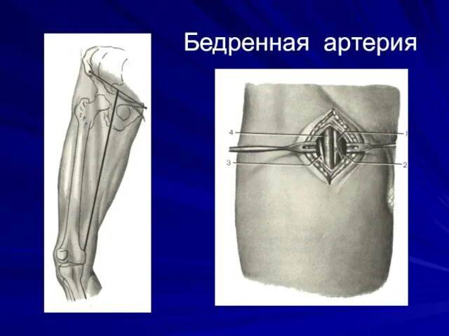 Бедренная артерия