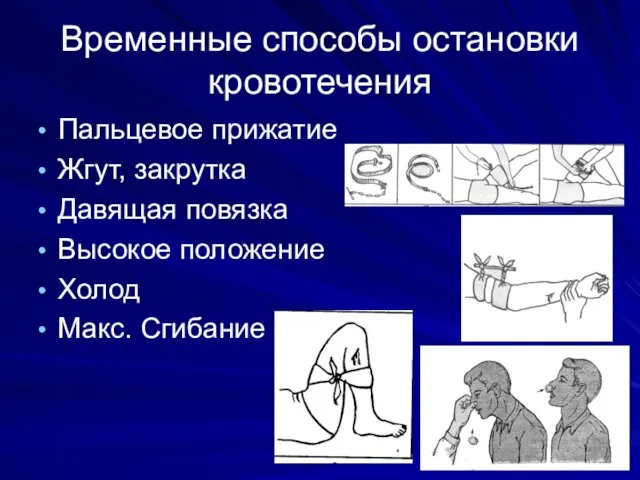 Временные способы остановки кровотечения Пальцевое прижатие Жгут, закрутка Давящая повязка Высокое положение Холод Макс. Сгибание